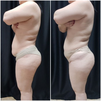 Наталя Кудряшова, Чернівці Фото - 11