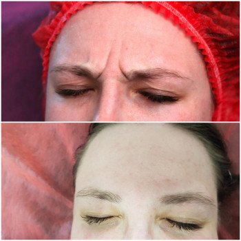 Наталя Кудряшова, Чернівці Фото - 14