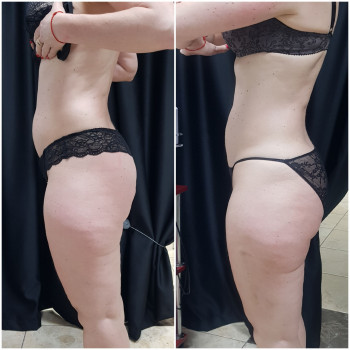 Наталя Кудряшова, Чернівці Фото - 18