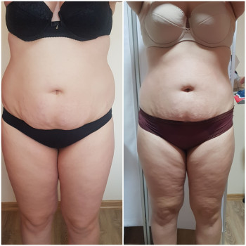 Наталя Кудряшова, Чернівці Фото - 19