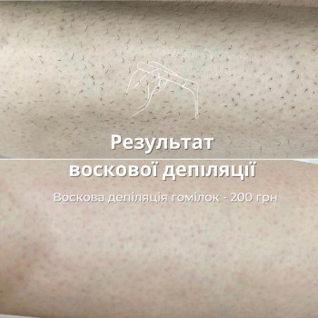 Депіляція гомілок воском/цукром
                    Салон красоты Мастерская Красоты "Юлии Юдиной" Киев