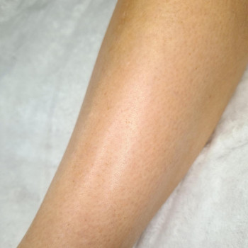 Комплекс лазерної епіляції №1 (ноги повністю + глибоке бікіни + пахви)
                    Салон красоты Мастерская Красоты "Юлии Юдиной" Киев