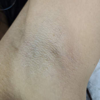 Комплекс лазерної епіляції №1 (ноги повністю + глибоке бікіни + пахви)
                    Салон красоты Мастерская Красоты "Юлии Юдиной" Киев