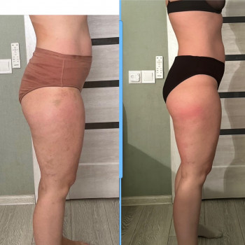 Надія Чубова, Запоріжжя Фото - 10