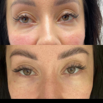 Regenova, Дніпро Фото - 5