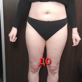 Антицелюлітний масаж
                    Масажист Ольга Харків