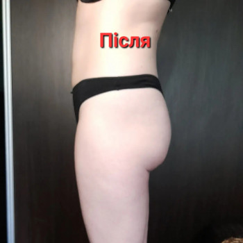 Антицелюлітний масаж
                    Масажист Ольга Харків