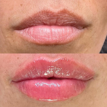 Ірина Горнова, Дніпро Фото - 5