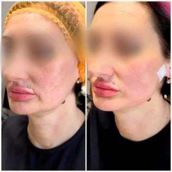 Оксана Сидоренко, Днепр Фото - 5