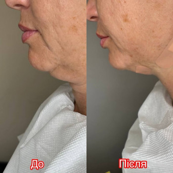 Анна , Дніпро Фото - 5