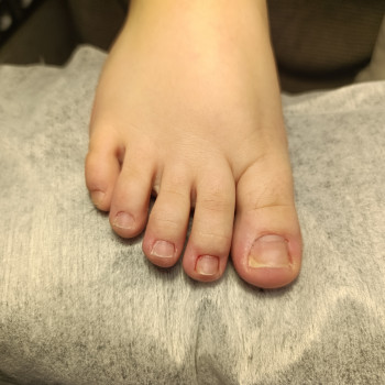 Педикюр
                    Мастер маникюра Тетяна Винница