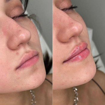 Тетяна Асколіна, Вінниця Фото - 3