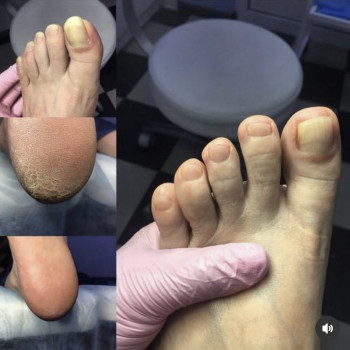 Фото з портфоліо майстра Рената (майстер манікюру, Львів)