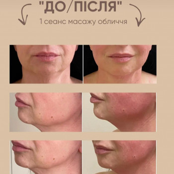 Масаж обличчя
                    Салон краси Vitality Ірпінь