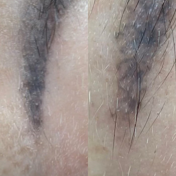 Зроблена одна процедура