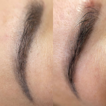 Зроблена одна процедура