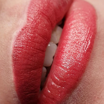 Одразу після процедури