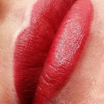 Одразу після процедури 
2000 грн