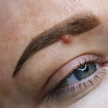 Брови одразу після процедури 
2000 грн