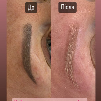 Видалення тату
                    Мастер перманентного макияжа Марьяна Киев