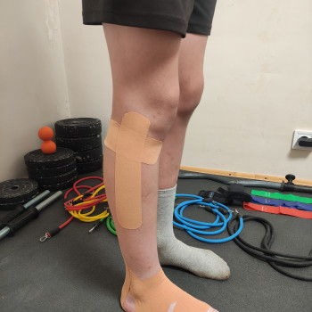 Тейпирования голеностопного сустава и малоберцовой кости после мануальной терапии. ( Хроническая тра...