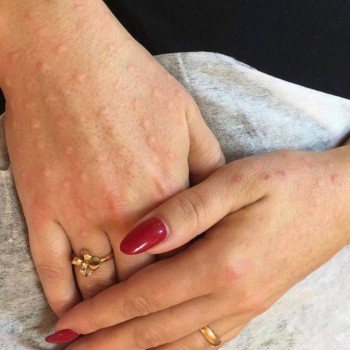 Дар'я Євтушенко, Київ Фото - 15