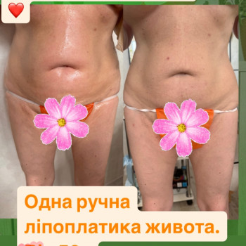 Ольга Хмелевская, Одесса Фото - 1