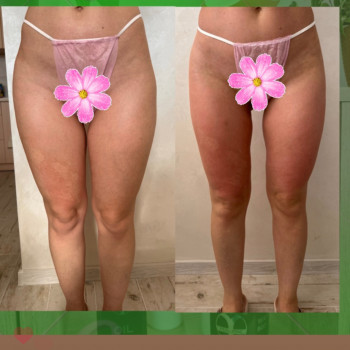 Ольга Хмелевская, Одесса Фото - 3