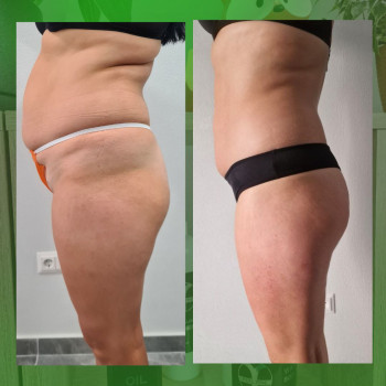 Ольга Хмелевская, Одесса Фото - 7