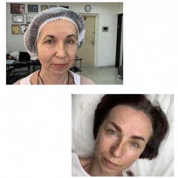 Перманентний макіяж брів
                    Майстер перманентного макіяжу Елена Київ