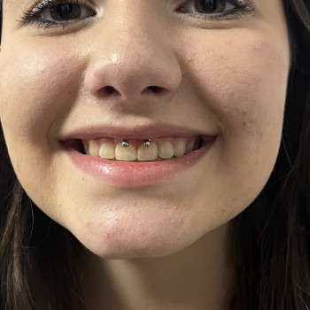 Svitlana Piercing, Вишнёвое Фото - 9