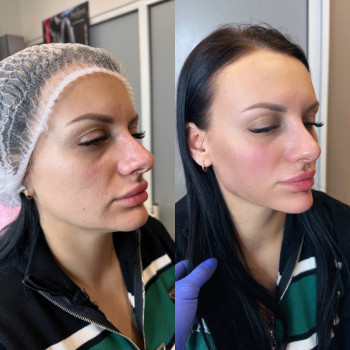 “Профиль Джоли»