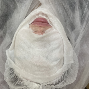 Комбинированная чистка лица
                    Косметолог Ирина Одеса