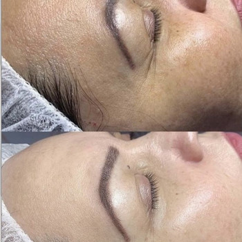 Молочный пилинг с ДМАЭ, осветление, увлажнение, лифтинг!🌹