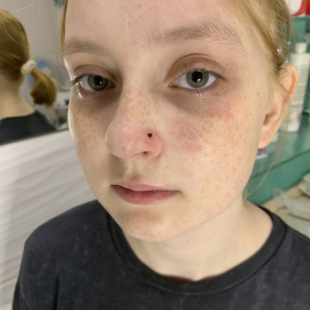 Пірсинг крила носа