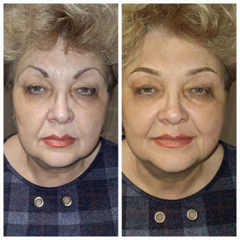 Фото ДО та ПІСЛЯ.
ПУДРОВЕ НАПИЛЕННЯ БРІВ