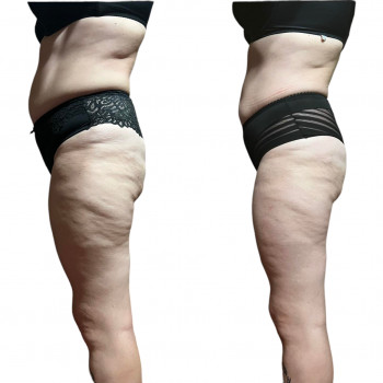 Ольга Мирошниченко, Лубни Фото - 3