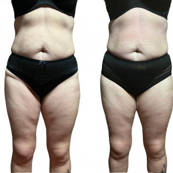 Ольга Мирошниченко, Лубни Фото - 4