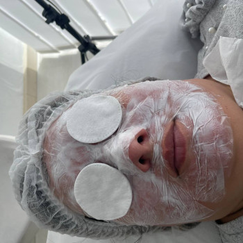 Комбінована чистка обличчя
                    Косметолог  Київ