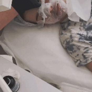 Комбінована чистка обличчя
                    Косметолог  Київ