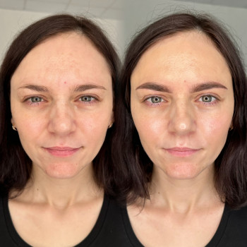 Перманент брів у пудровій техніці
                    Майстер перманентного макіяжу Ирина Кропивницький