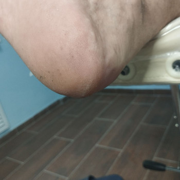 Чоловічій педикюр