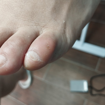 Альона Полякова, Горішні Плавні Фото - 13