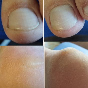 Альона Полякова, Горішні Плавні Фото - 5