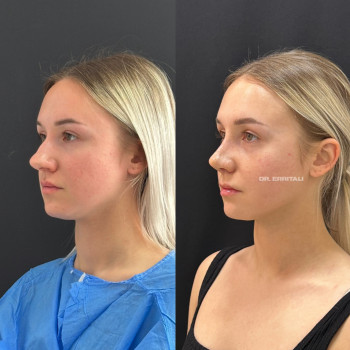 Абдель Эрритали, Харків Фото - 12