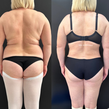 Абдель Эрритали, Харків Фото - 18