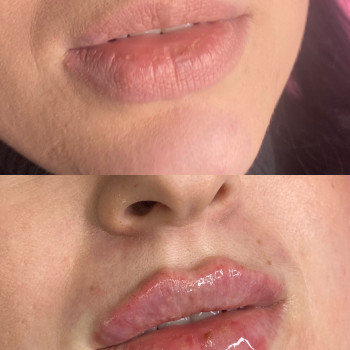 Вікторія Кравченко, Миргород Фото - 11