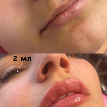 Вікторія Кравченко, Миргород Фото - 13