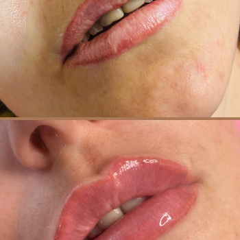 Вікторія Кравченко, Миргород Фото - 14