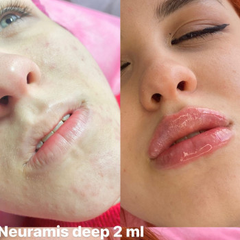 Вікторія Кравченко, Миргород Фото - 8